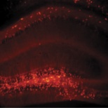 Hippocampus of Alzheimer's mutated mouse. CA1 region lit up