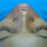 Eyelash Extensions